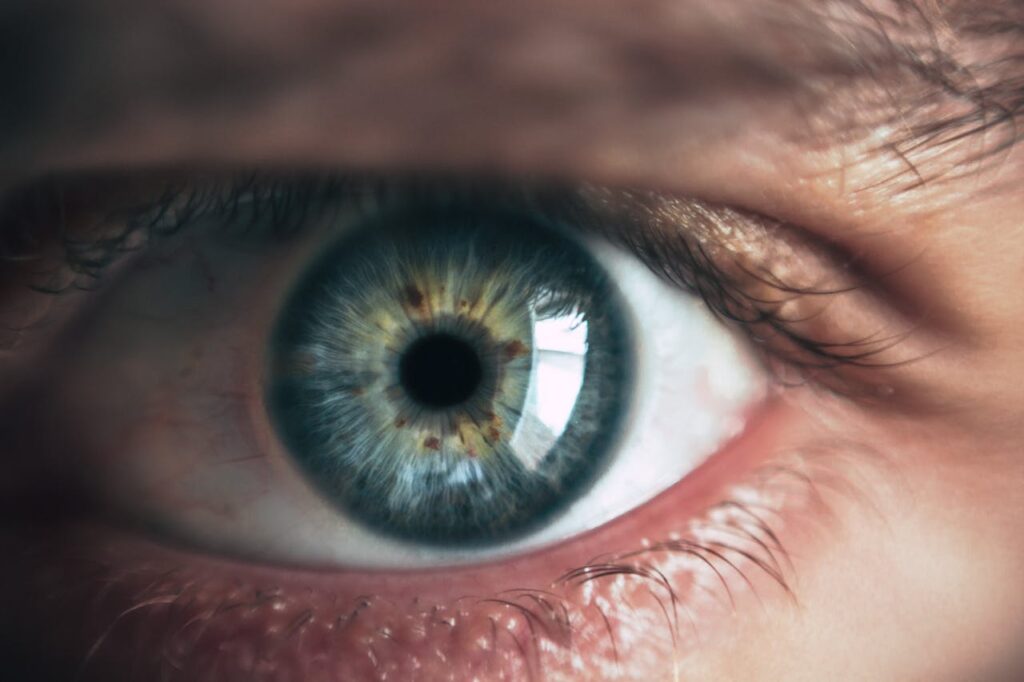 https://www.pexels.com/nl-nl/foto/persoon-oog-865711/ Uitslag onder oog hoe je het herkent en behandelt